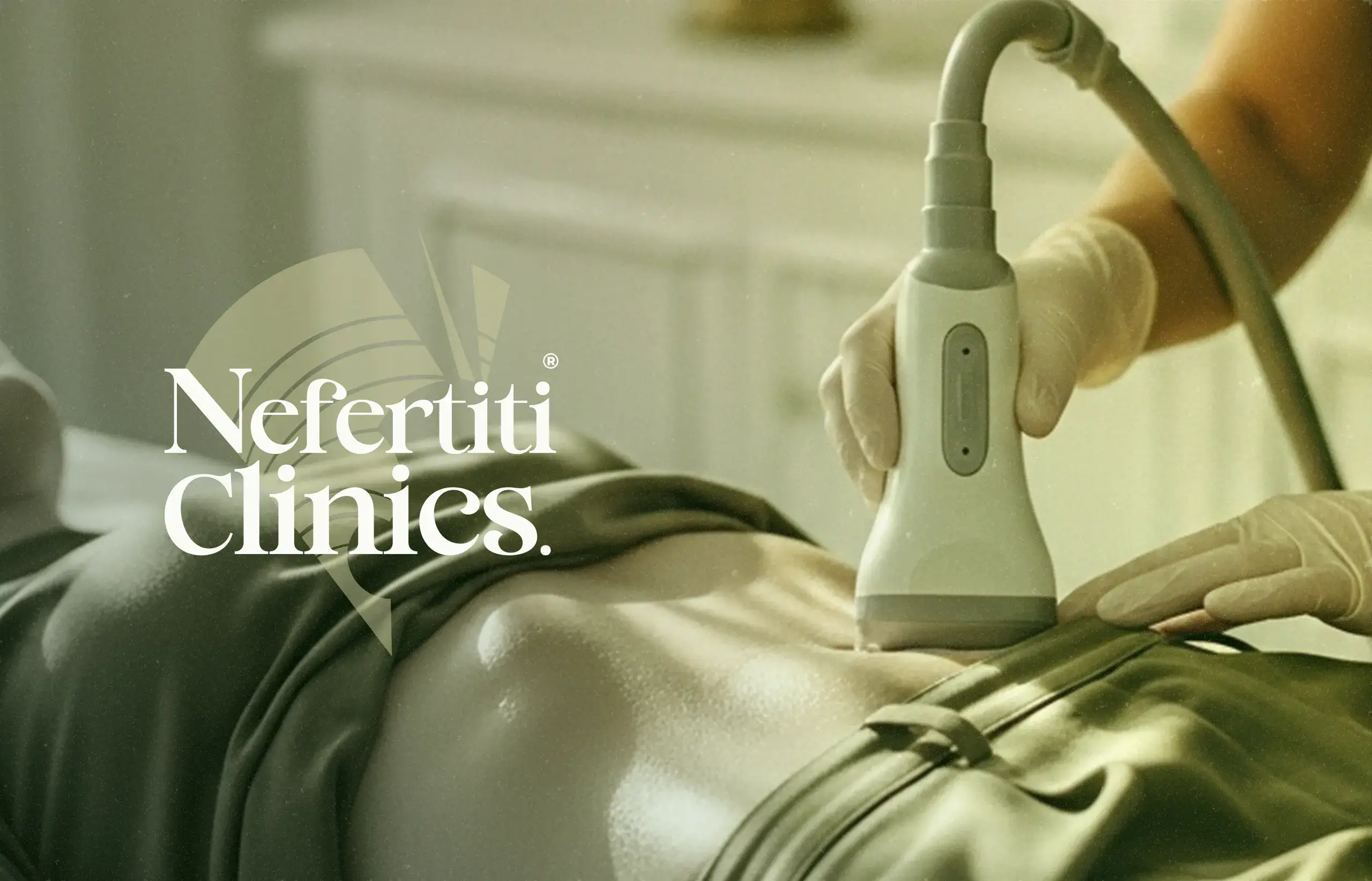 إذابة الدهون الموضعية