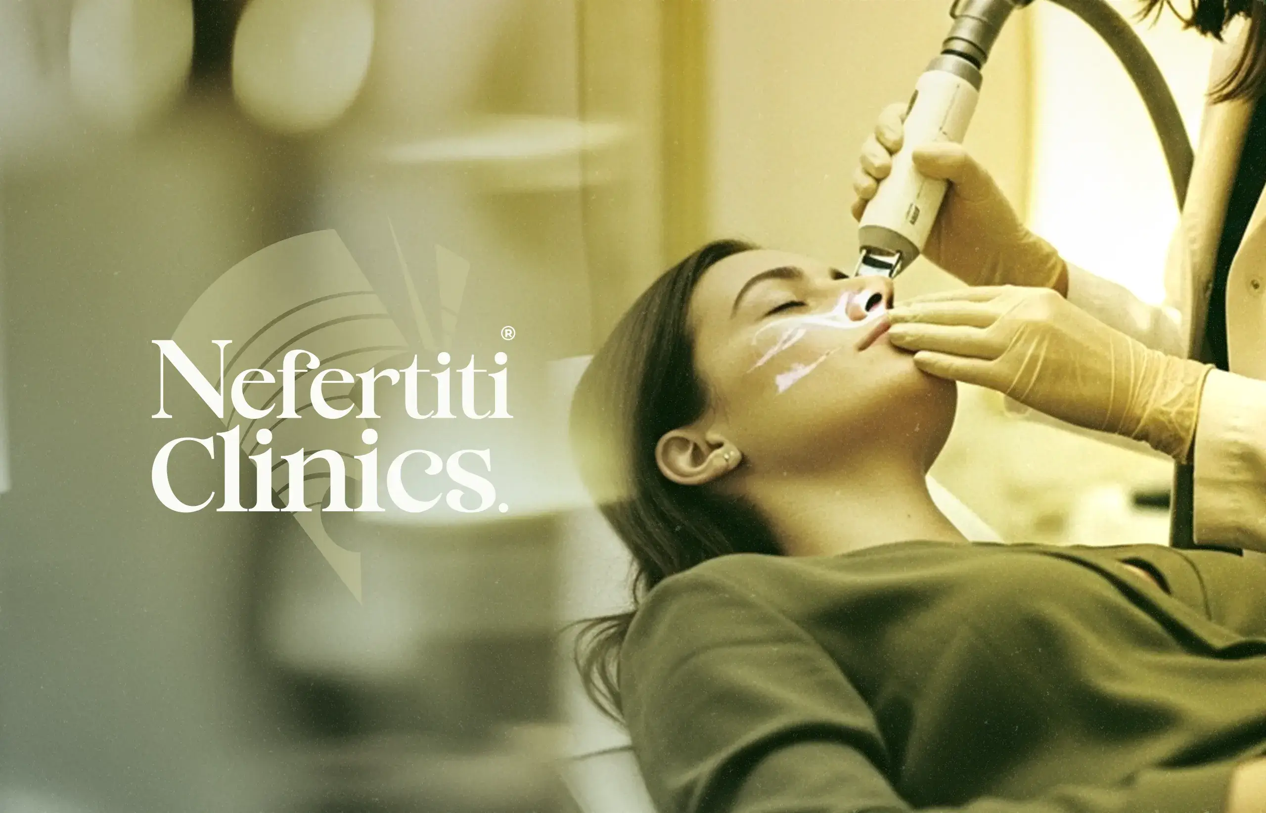 الفراكشنال ليزر للوجه