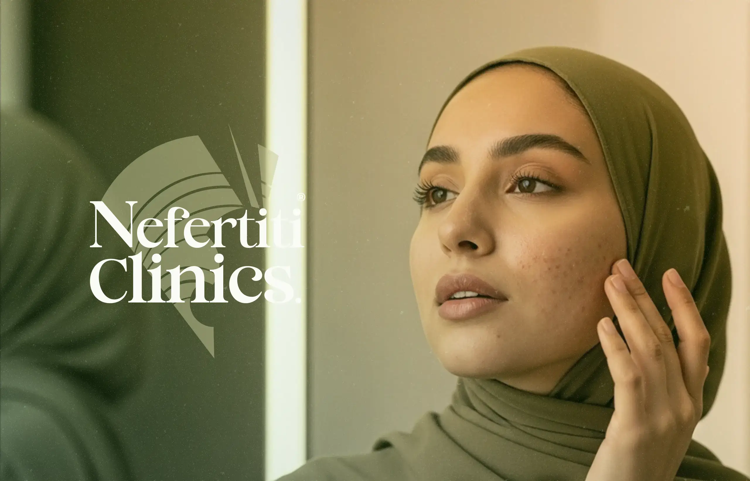 آثار حب الشباب