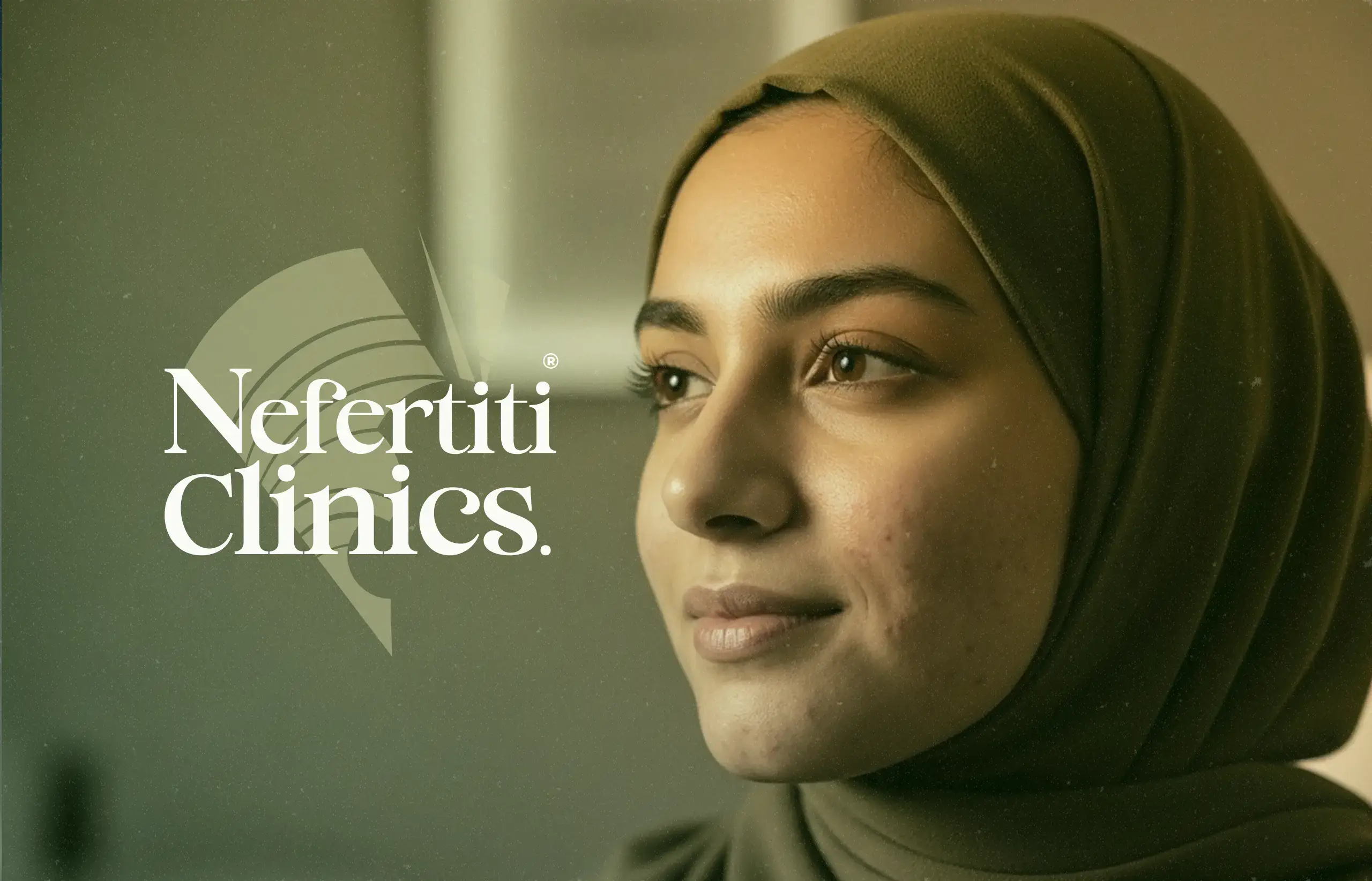 آثار حب الشباب