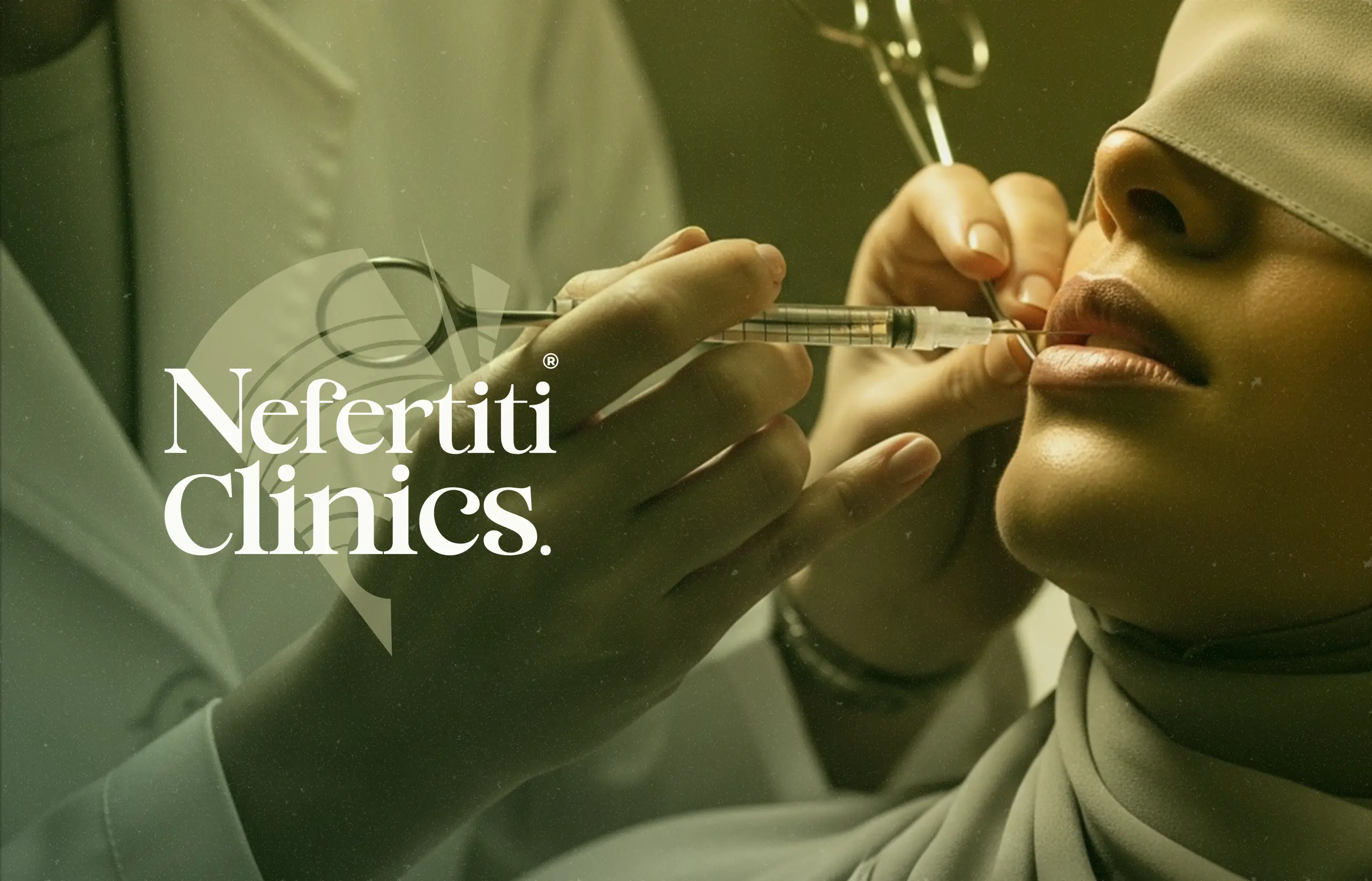 بوتكس الابتسامة اللثوية