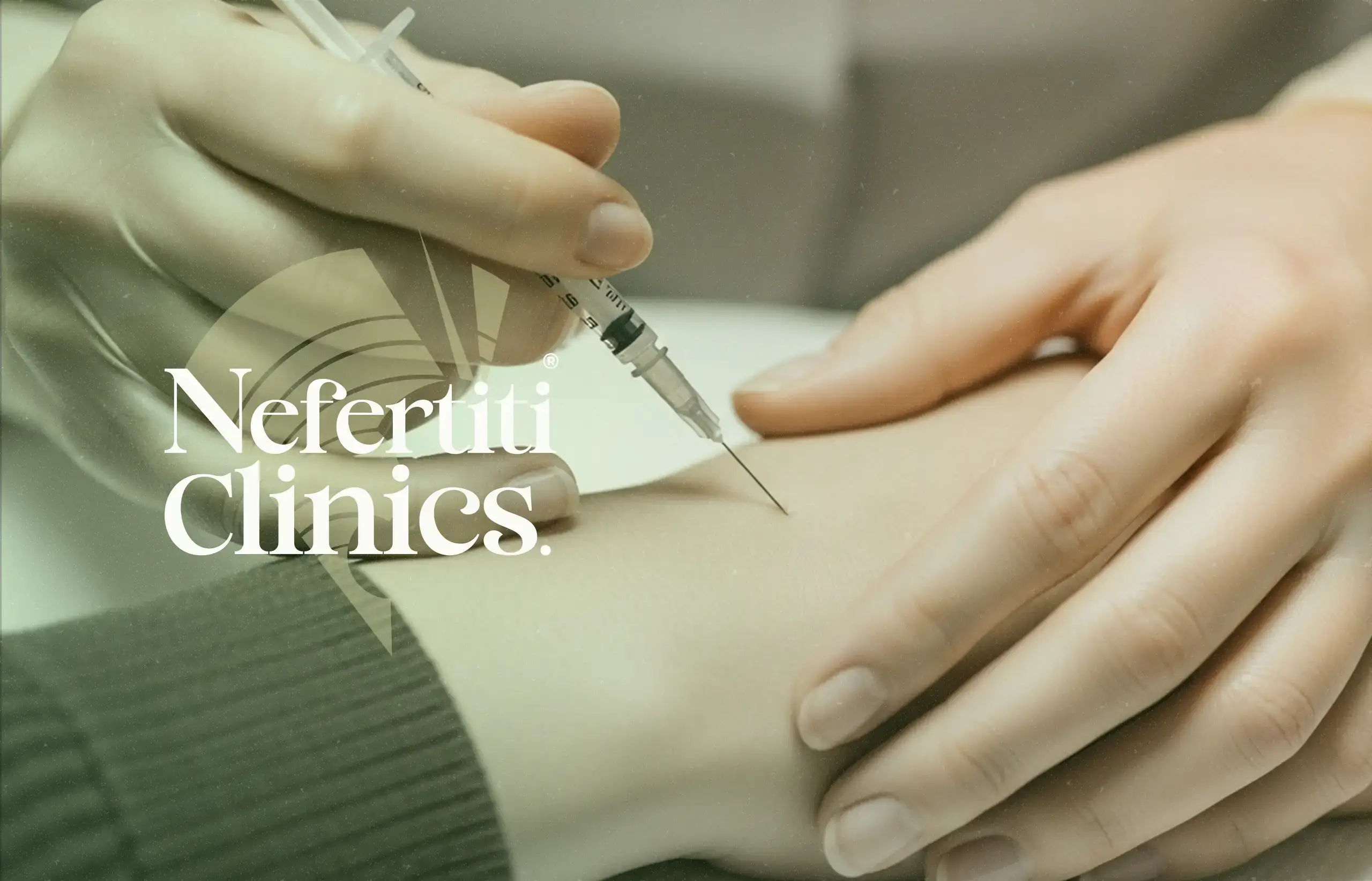 الفيلر لليدين