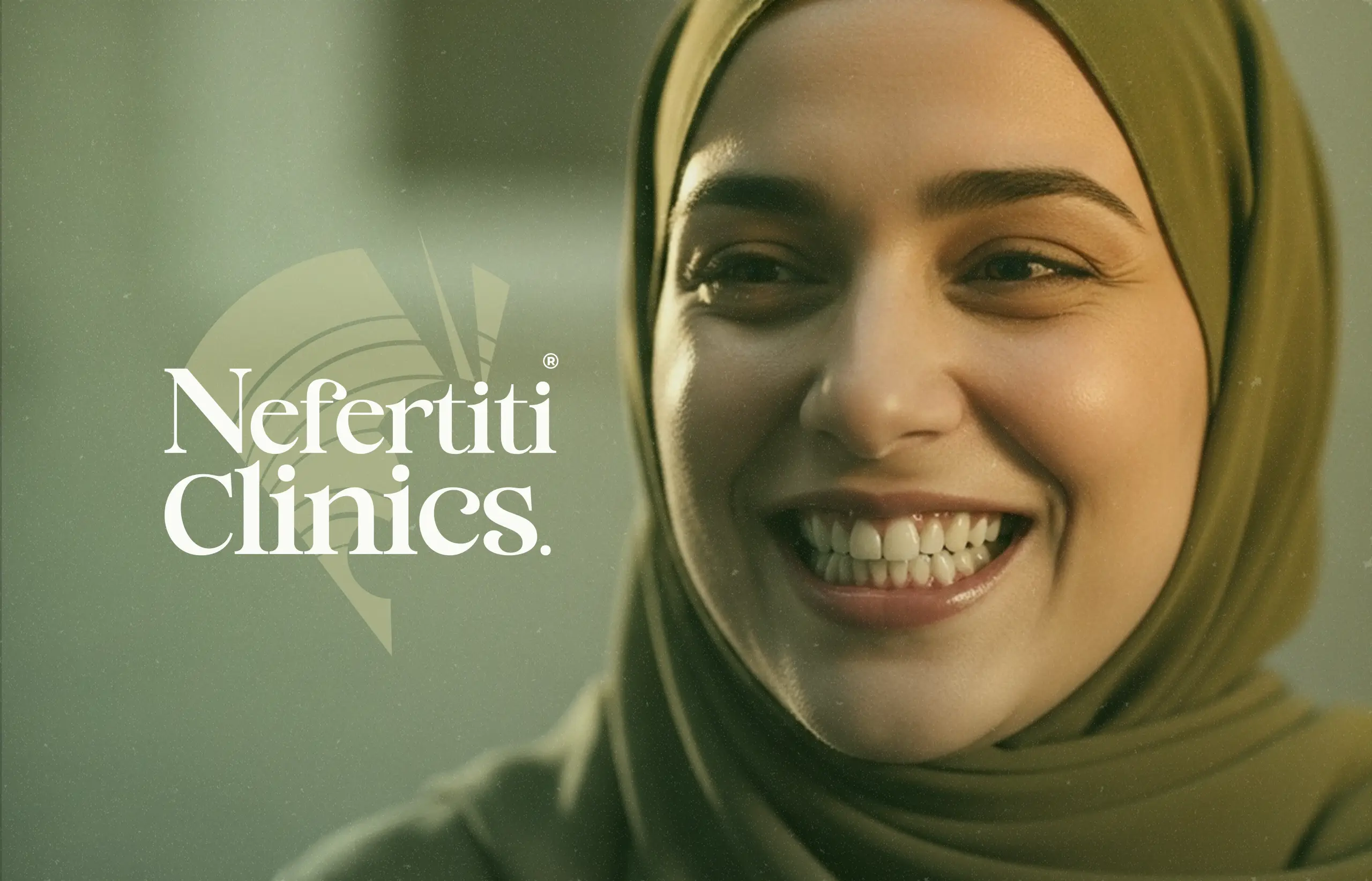 بوتكس الابتسامة اللثوية