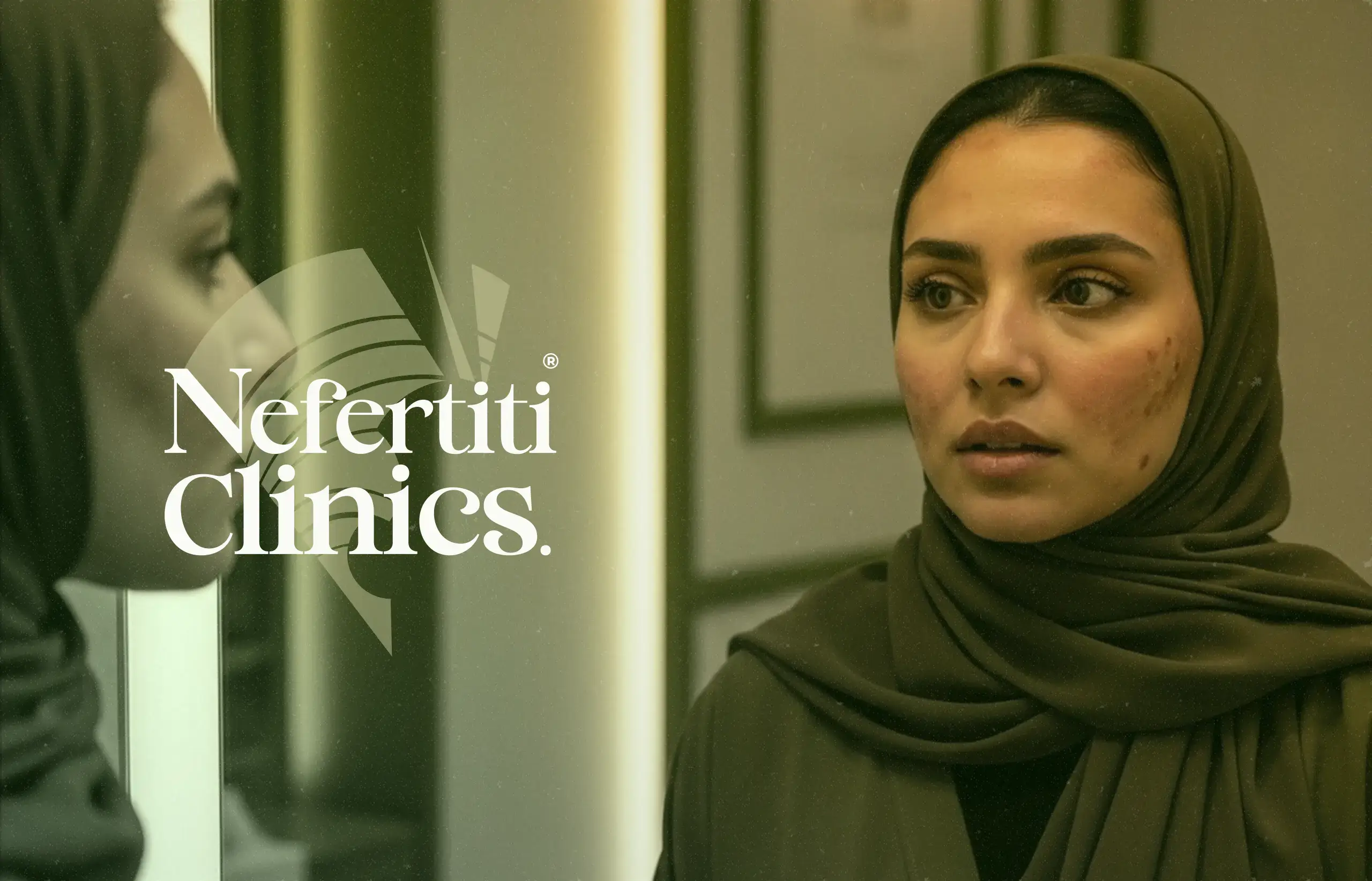 علاج التصبغات