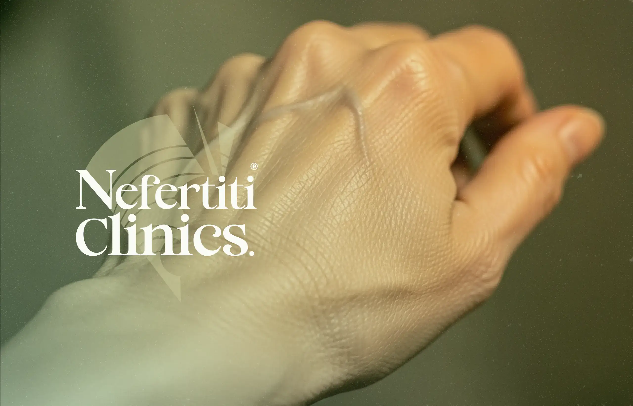 الفيلر لليدين