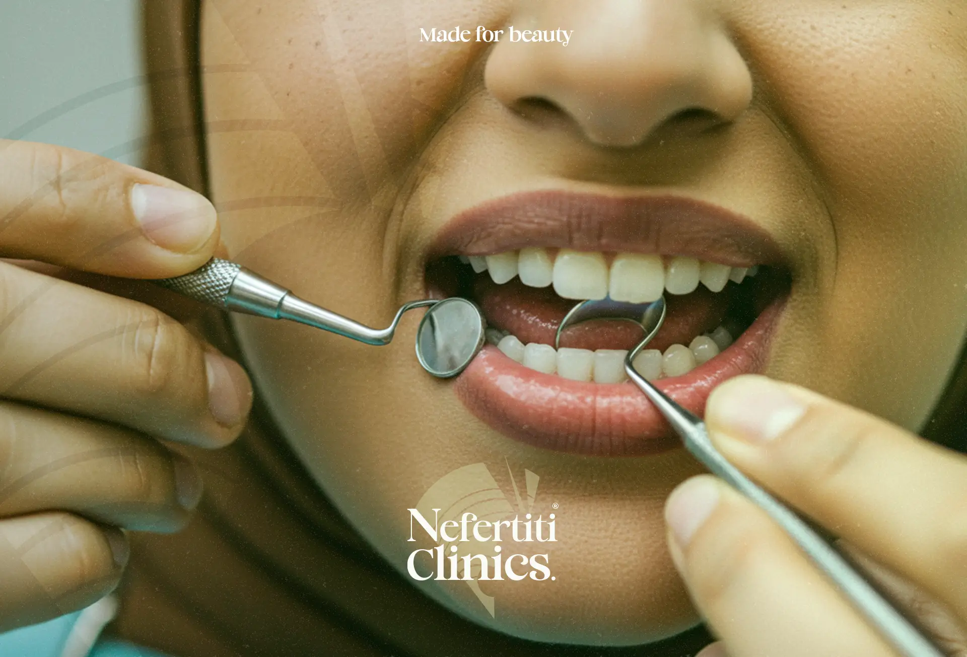 علاج اللثة سوهاج